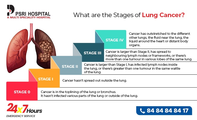 what are the stages of lung cancer