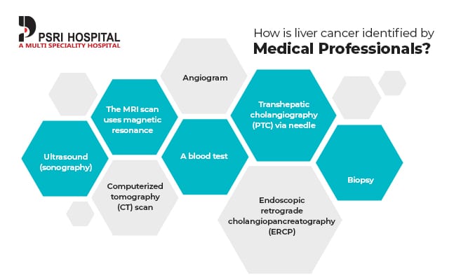 how is liver cancer identified by medical professionals
