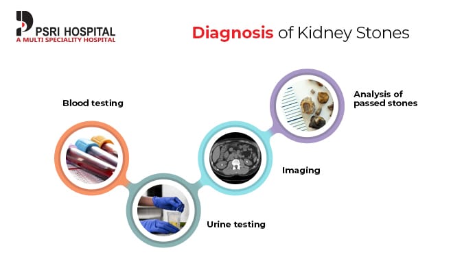 diagnosis of kidney stones