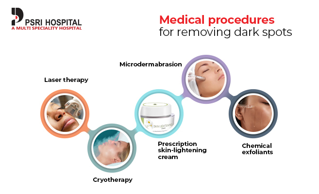 medical procedure for dark spot removal