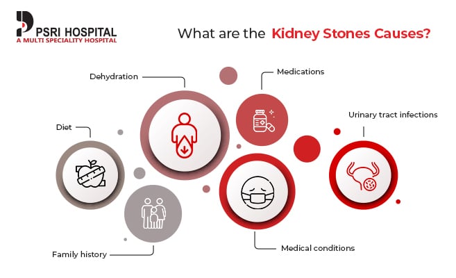 Image result for What Leads to Kidney Stones? infographics