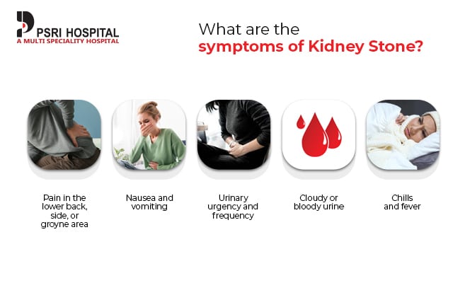 what are the symptoms of kidney stone