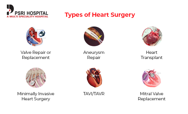 heart surgery
