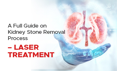A Full Guide on Kidney Stone Removal Process – Laser treatment