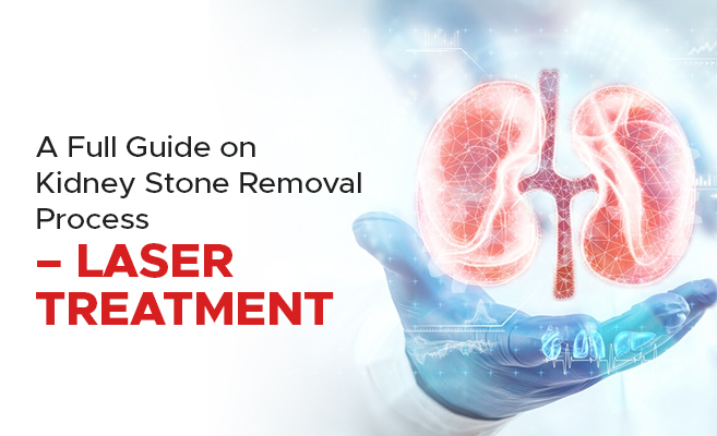  A Full Guide on Kidney Stone Removal Process – Laser treatment 