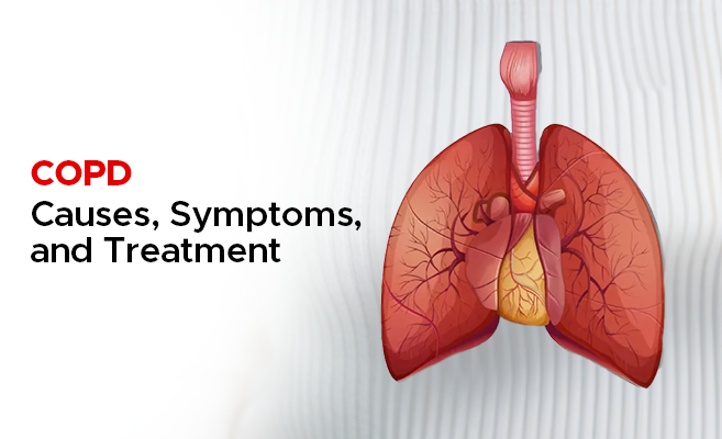  COPD – Causes, Symptoms, and Treatment 