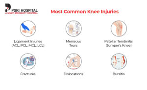 Most Common Knee Injuries and How To Prevent Them