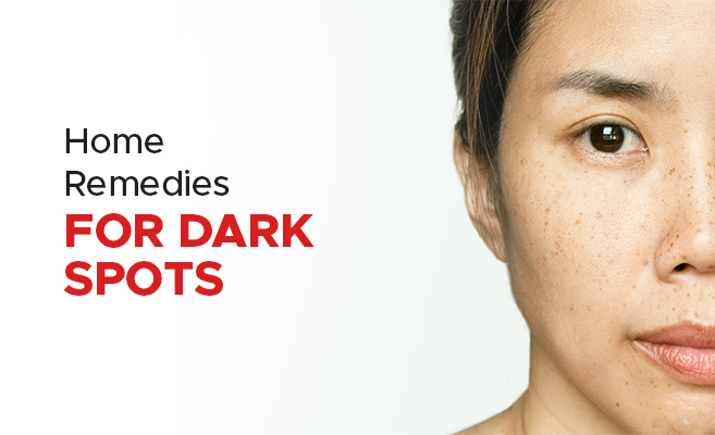 Home Remedies To Remove Dark Spots on the Face Overnight Naturally?