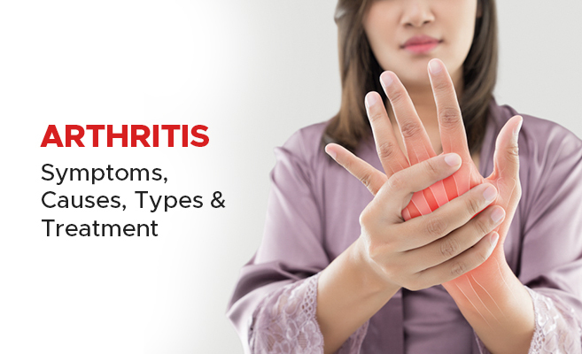  Arthritis: Symptoms, Causes, Types & Treatment 