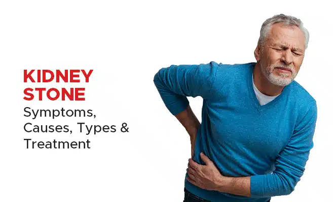 Kidney stones - symptoms, causes and treatment 