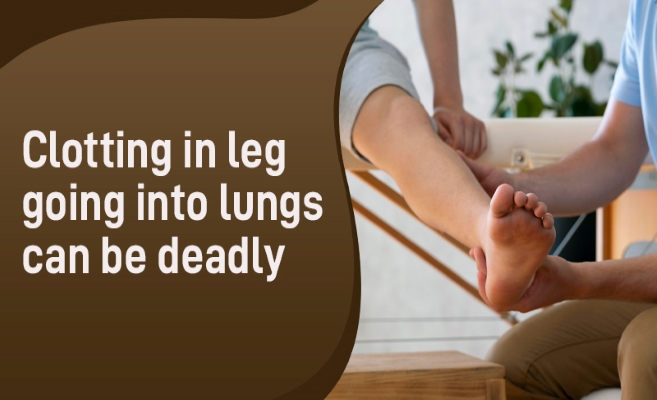  Clotting in leg going into lungs can be deadly 