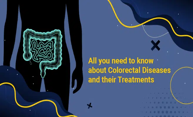  All you need to know about Colorectal Diseases and their Treatments 