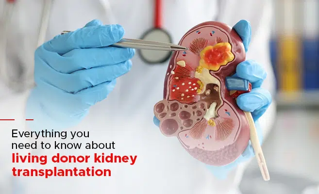  What You Should Know About Living Donor Kidney Transplants 