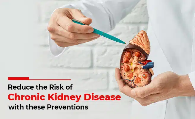  How Can You Reduce The Risk Of Chronic Kidney Disease? 