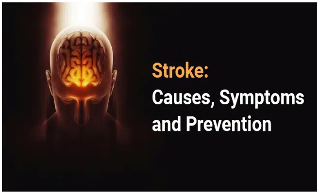  Stroke: Causes, Symptoms and Prevention 