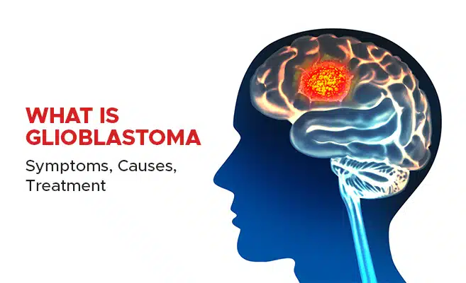  What Is Glioblastoma – Symptoms, Causes, Treatment 