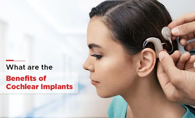  What are the Benefits of Cochlear Implants? 