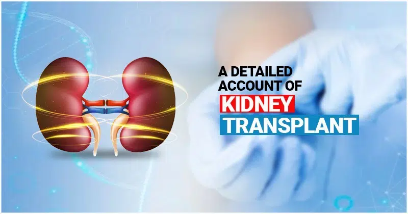  A Detailed Account Of  Kidney Transplant 
