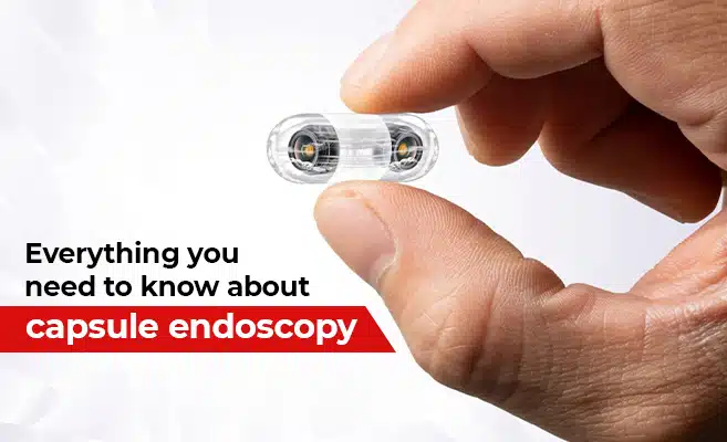 Everything You Need to Know About Capsule Endoscopy