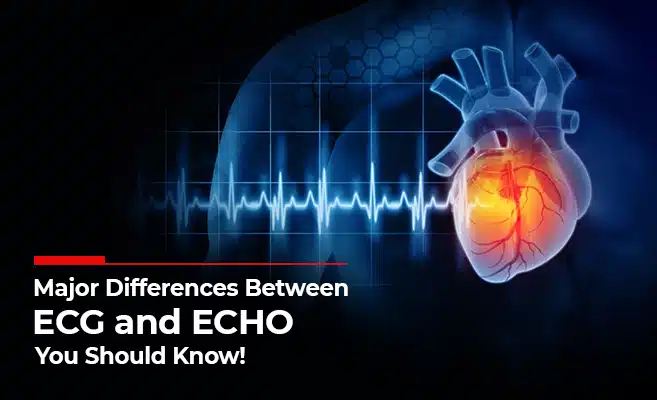  Difference Between ECG And ECHO? 