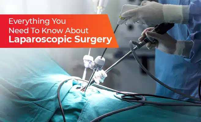  Everything You Need To Know About Laparoscopic Surgery 