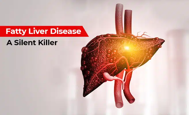 Fatty Liver Disease: A Silent Killer | Symptoms & Causes