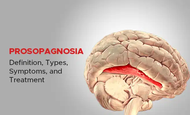 Prosopagnosia – Definition, Types, Symptoms, and Treatment
