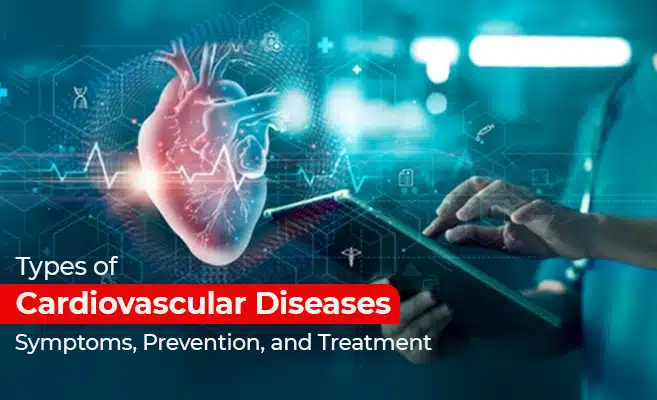  Types of Cardiovascular Diseases: Symptoms Prevention and Treatment 
