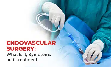 What is Endovascular Surgery and How it’s Performed