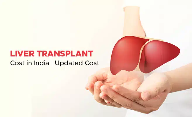  Liver Transplant Cost in India | Updated Cost 