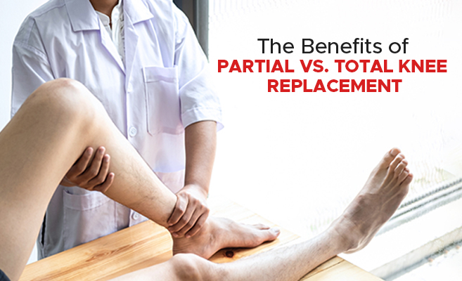  The Benefits of Partial vs. Total Knee Replacement 