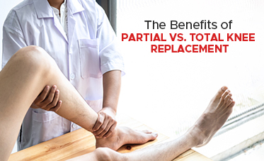 The Benefits of Partial vs. Total Knee Replacement