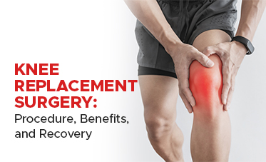 Knee Replacement Surgery: Procedure, Benefits, and Recovery
