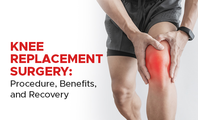  Knee Replacement Surgery: Procedure, Benefits, and Recovery 