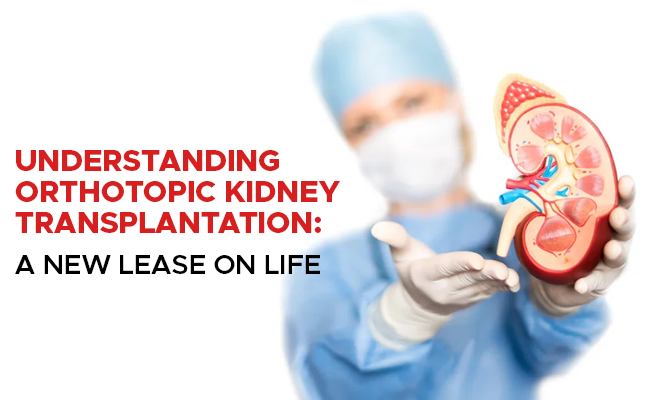  Understanding Orthotopic Kidney Transplantation: A New Lease on Life 