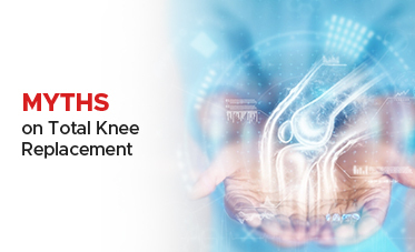 Myths on Total Knee Replacement