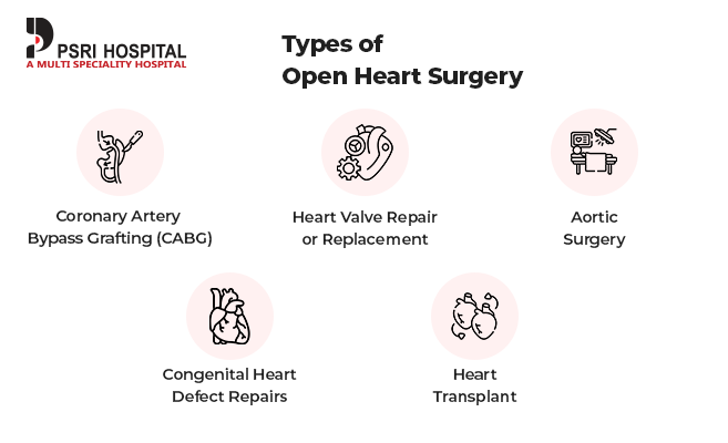 open heart surgery