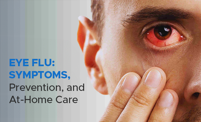  Eye Flu: Symptoms, Prevention, and At-Home Care 