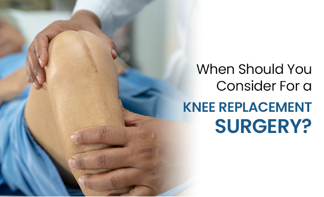  When Should You Consider For a Knee Replacement Surgery? 