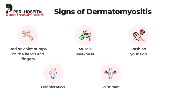 what is dermatomyositis