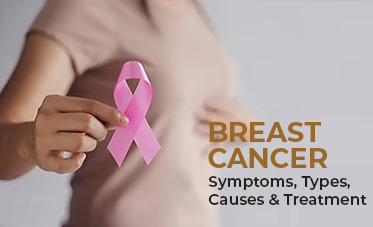  Breast Cancer: Symptoms, Types, Causes & Treatment 