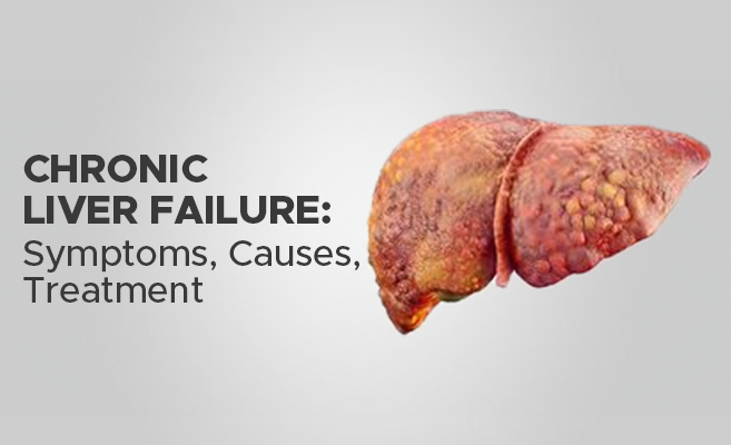  Chronic Liver Failure: Symptoms, Causes, Treatment 