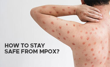  How to Stay Safe from Mpox? 