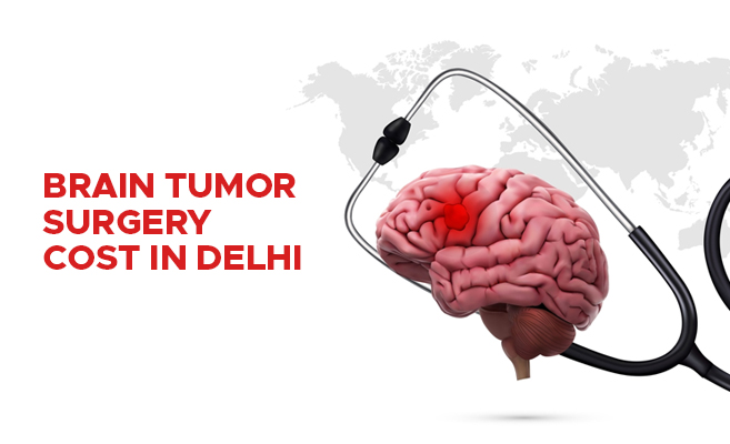  Brain Tumor Surgery Cost In Delhi 