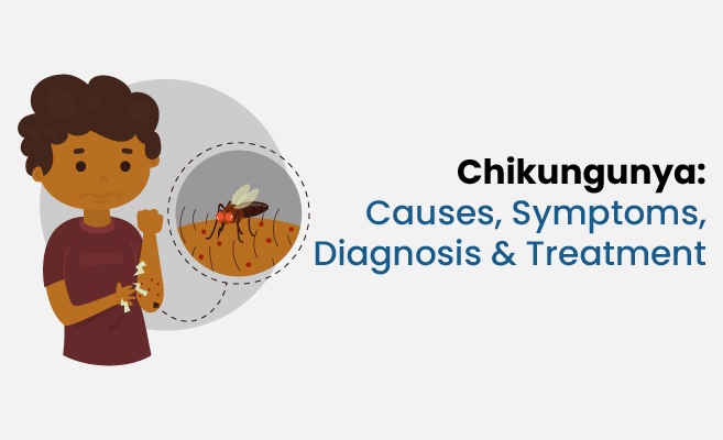  Chikungunya: Causes, Symptoms, Diagnosis & Treatment 