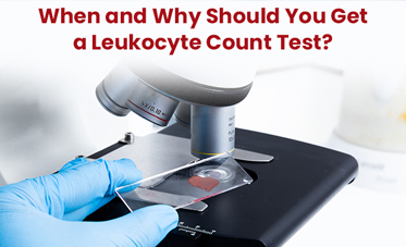 Leukocyte Count: A Comprehensive Guide to Normal Levels, Testing Methods, and Procedures
