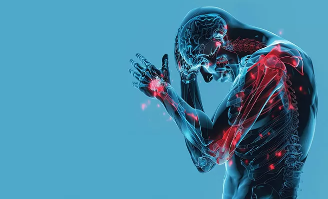  Neuropathic Pain (Nerve Pain): Causes, Symptoms & Treatment 