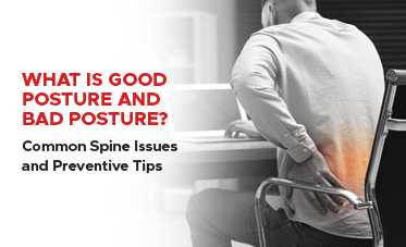 What is Good Posture and Bad Posture? Common Spine Issues and Preventive Tips
