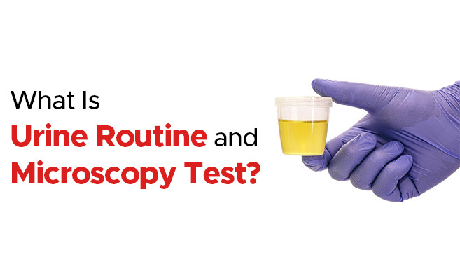  Urine Routine and Microscopy Test: Normal Range, Purpose & Benefits 