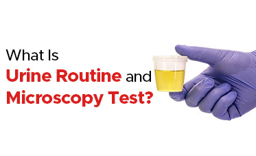 Urine Routine and Microscopy Test: Normal Range, Purpose & Benefits